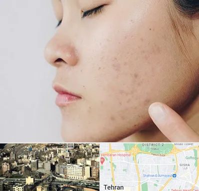 دکتر جوش صورت در مرزداران 