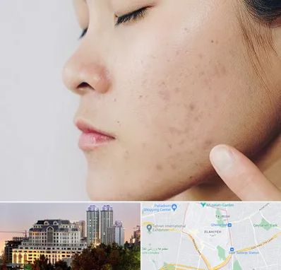 دکتر جوش صورت در فرشته 