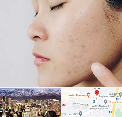 دکتر جوش صورت در جردن 