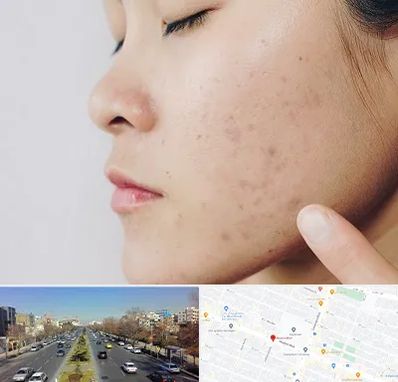 دکتر جوش صورت در بلوار معلم مشهد