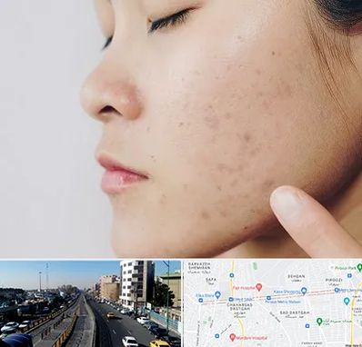 دکتر جوش صورت در پیروزی 