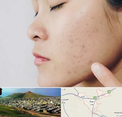 دکتر جوش صورت در بیجار