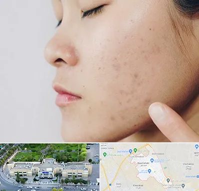 دکتر جوش صورت در نسیم شهر