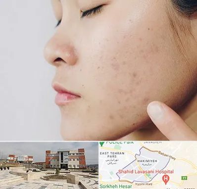 دکتر جوش صورت در حکیمیه 