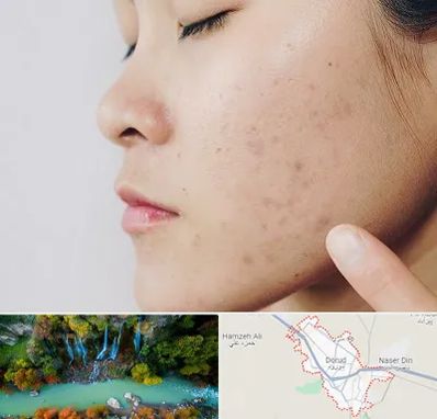 دکتر جوش صورت در دورود