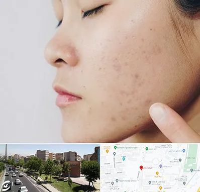 دکتر جوش صورت در شهرک آزمایش