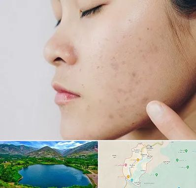 دکتر جوش صورت در رودبار