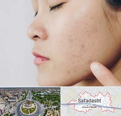 دکتر جوش صورت در صفادشت