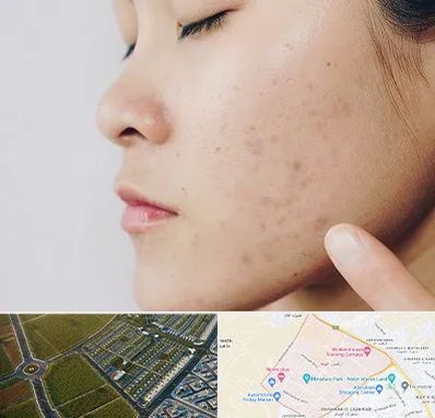 دکتر جوش صورت در الهیه مشهد