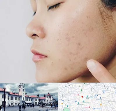 دکتر جوش صورت در میدان شهرداری رشت