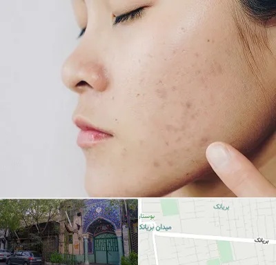دکتر جوش صورت در بریانک
