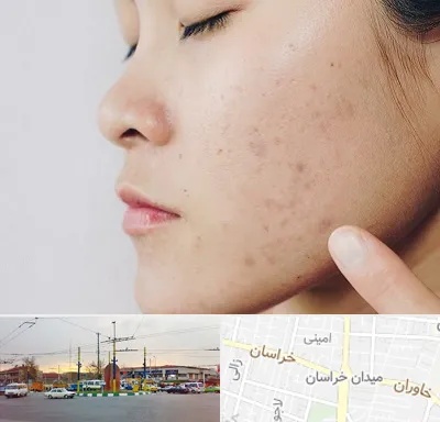 دکتر جوش صورت در میدان خراسان