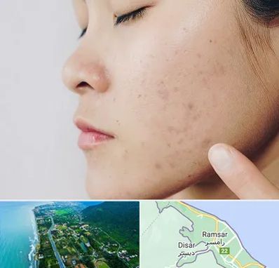 دکتر جوش صورت در رامسر