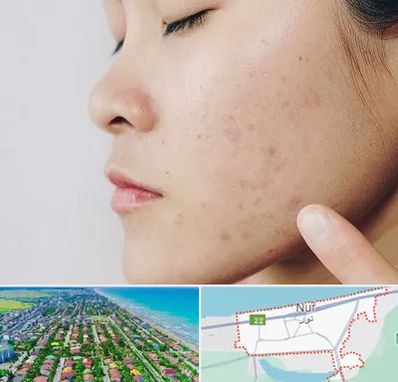 دکتر جوش صورت در نور