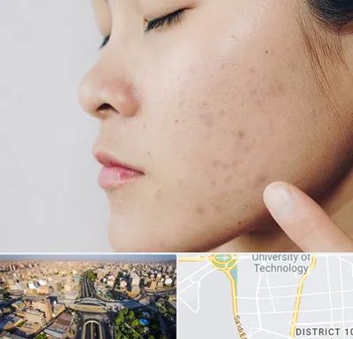 دکتر جوش صورت در استاد معین 