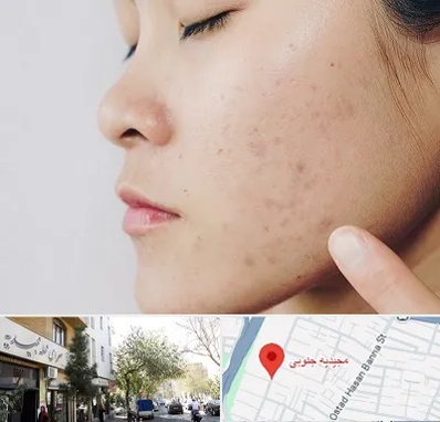 دکتر جوش صورت در مجیدیه جنوبی