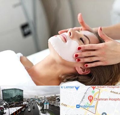 فیشیال صورت در اقدسیه 