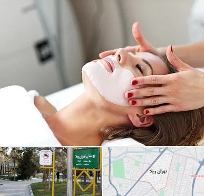 فیشیال صورت در تهران ویلا