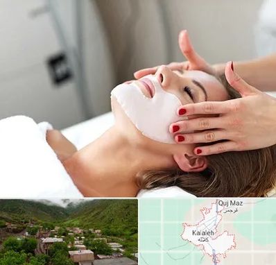 فیشیال صورت در کلاله