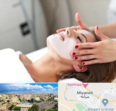 فیشیال صورت در میانه