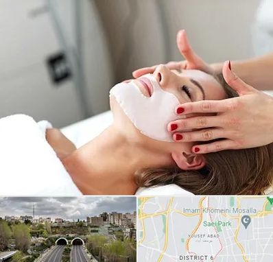 فیشیال صورت در یوسف آباد 