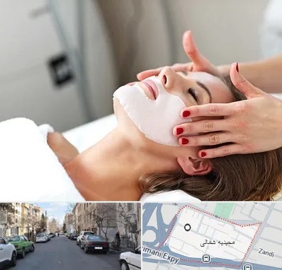 فیشیال صورت در مجیدیه شمالی