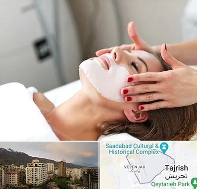 فیشیال صورت در زعفرانیه 