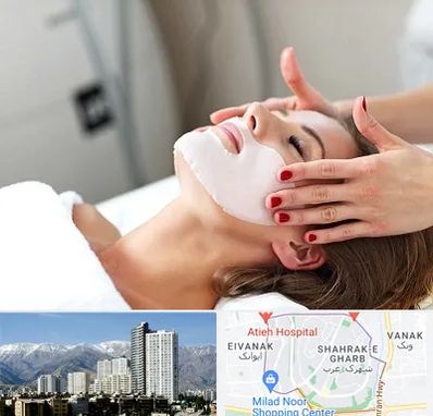 فیشیال صورت در شهرک غرب 