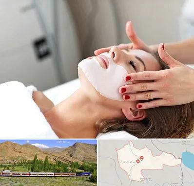 فیشیال صورت در خاش