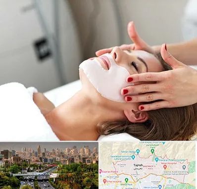 فیشیال صورت در منطقه 1 تهران