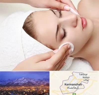 پاکسازی صورت در کرمانشاه