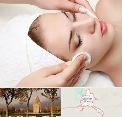 پاکسازی صورت در تویسرکان