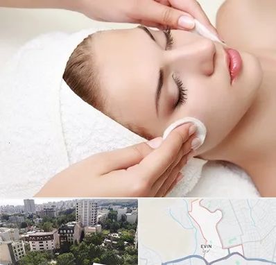 پاکسازی صورت در اوین