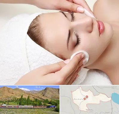 پاکسازی صورت در خاش
