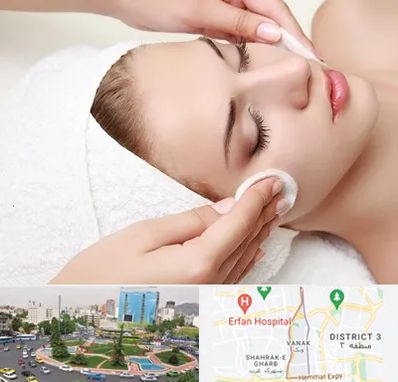 پاکسازی صورت در ونک 