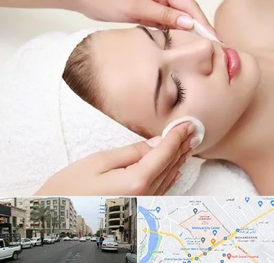 پاکسازی صورت در زیتون کارمندی اهواز