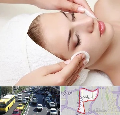 پاکسازی صورت در امیرآباد