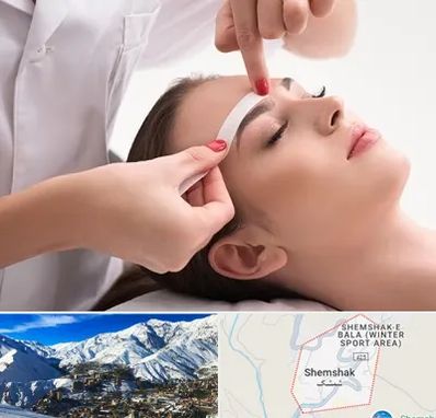 اپیلاسیون در شمشک