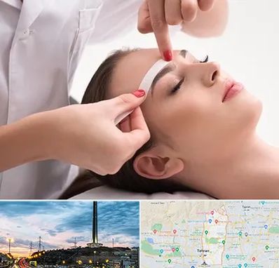 اپیلاسیون در منطقه 2 تهران