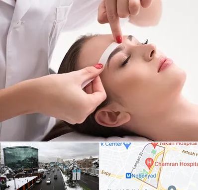 اپیلاسیون در اقدسیه 