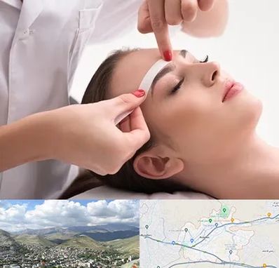 اپیلاسیون در رودهن