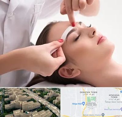 اپیلاسیون در اکباتان 