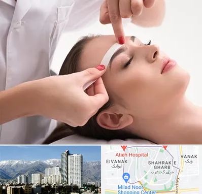 اپیلاسیون در شهرک غرب 