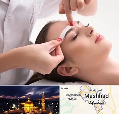 اپیلاسیون در مشهد