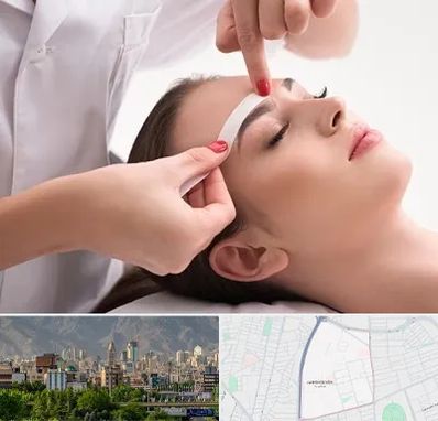 اپیلاسیون در جمشیدیه