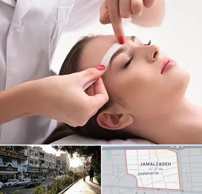 اپیلاسیون در خیابان جمالزاده