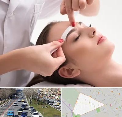 اپیلاسیون در احمدآباد مشهد