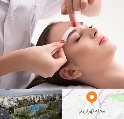 اپیلاسیون در تهران نو