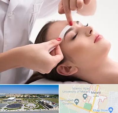 اپیلاسیون در ملارد