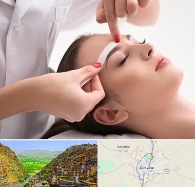اپیلاسیون در کامیاران